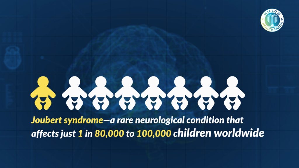 Joubert Syndrome: ‘My baby couldn’t lift his head, or sit down’  